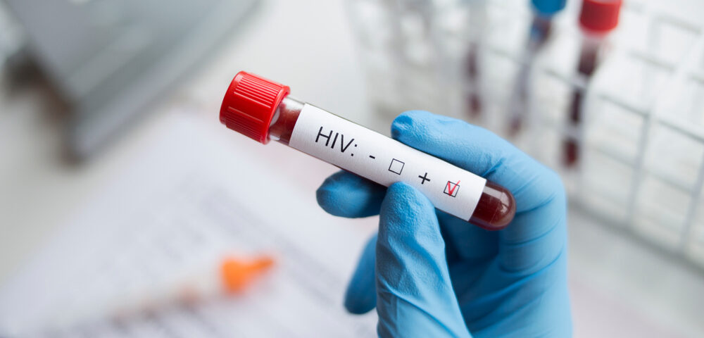 HIV