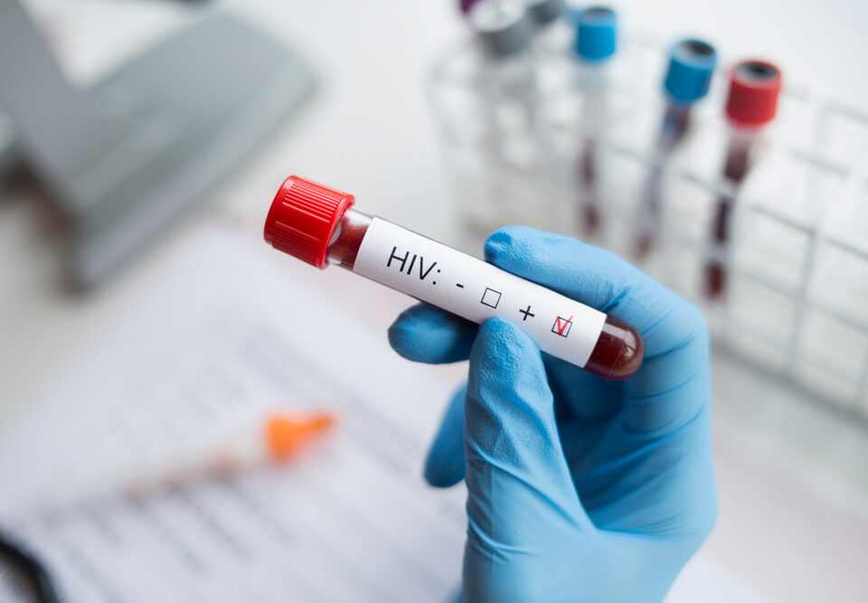 HIV